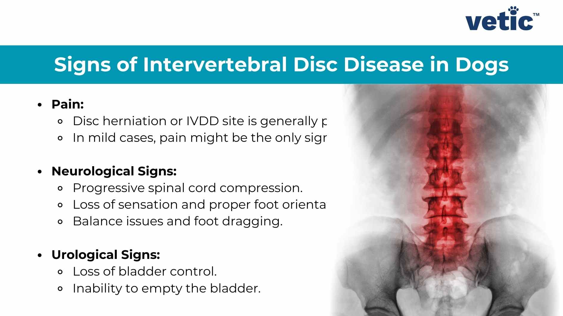 An educational image featuring the title “What Causes IVDD in Dogs?” with the logo of ‘vetic’ in the top right corner. Below the title, there is a paragraph explaining that Intervertebral Disc Disease (IVDD) in dogs is caused by the structure made of individual vertebrae called intervertebral discs separating the vertebrae. It mentions that these discs can harden and press on the spinal cord when they shoot upwards due to degeneration of the vertebral column. On the right side, there are two diagrams illustrating a normal intervertebral disc and a protruded intervertebral disc pressing against the spinal cord. Below, an illustration of a dog with its spine highlighted shows where IVDD can occur.